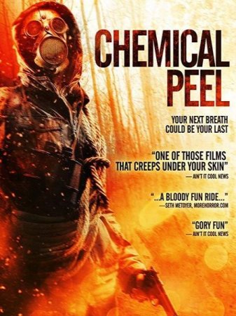 В хорошем качестве Химическая чистка / Chemical Peel (2014)